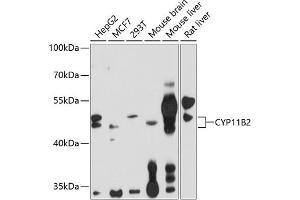 Western blot analysis of extracts of various cell lines, using CYP11B2 antibody (ABIN1679468, ABIN3015492, ABIN3015493 and ABIN6218533) at 1:1000 dilution. (CYP11B2 antibody  (AA 234-503))