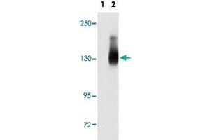 Western blot analysis of JAG2 (arrow) using JAG2 polyclonal antibody . (JAG2 antibody  (C-Term))