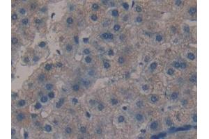 Detection of MBL in Human Liver Tissue using Polyclonal Antibody to Mannose Binding Lectin (MBL) (MBL2 antibody  (AA 130-248))