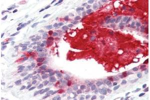 Anti-APRIL antibody IHC staining of human breast. (TNFSF13 antibody  (Internal Region))