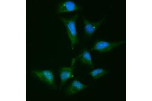 IF analysis of Alpha Actinin 4 using anti-Alpha Actinin 4 antibody (ABIN4886421).