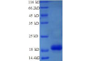 SDS-PAGE (SDS) image for Lysine (K)-Specific Demethylase 5A (KDM5A) (AA 437-603) protein (His tag) (ABIN5713580) (KDM5A Protein (AA 437-603) (His tag))