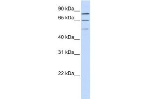 WB Suggested Anti-ZNF699 Antibody Titration:  0.