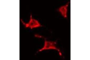 ABIN6266801 staining 293 by IF/ICC. (YTHDF1 antibody  (N-Term))