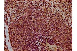 IHC image of ABIN7147649 diluted at 1:300 and staining in paraffin-embedded human spleen tissue performed on a Leica BondTM system. (CHODL antibody  (AA 105-206))