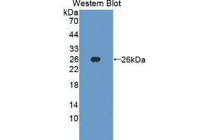 Detection of Recombinant SKP1, Human using Polyclonal Antibody to S-Phase Kinase Associated Protein 1 (SKP1) (SKP1 antibody  (AA 1-163))