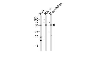 Western blot analysis of lysates from Hela cell line , human brain and mouse cerebellum tissue lysate(from left to right), using PFTK1 Antibody (N-term ) A.