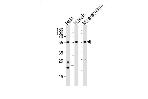 CDK14 Antikörper  (N-Term)