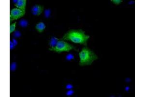 Anti-BDH2 mouse monoclonal antibody (ABIN2452802) immunofluorescent staining of COS7 cells transiently transfected by pCMV6-ENTRY BDH2 (RC210586). (BDH2 antibody)