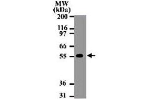 Western blot analysis of 15 ug of total cell lysate from Daudi cells with TNFRSF10A monoclonal antibody, clone 32A1380  at 2 ug/mL . (TNFRSF10A antibody  (AA 1-20))