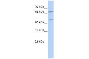 SLC5A7 antibody used at 1 ug/ml to detect target protein.