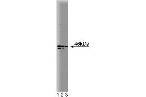Western blot analysis of Nek2 on a Jurkat cell lysate. (NEK2 antibody  (AA 244-444))