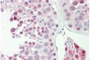 Human Testis: Formalin-Fixed, Paraffin-Embedded (FFPE) (Spindlin 1 antibody  (AA 111-160))