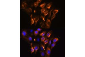 Immunofluorescence analysis of C6 cells using  Rabbit pAb (ABIN6134011, ABIN6136599, ABIN6136600 and ABIN6224718) at dilution of 1:100. (ADRB3 antibody  (AA 1-100))