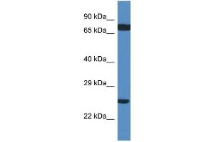 WB Suggested Anti-RPL7A AntibodyTitration: 1. (RPL7A antibody  (C-Term))