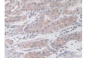 Immunohistochemistry (IHC) image for anti-Mitogen-Activated Protein Kinase 12 (MAPK12) (AA 27-311) antibody (ABIN7441064)