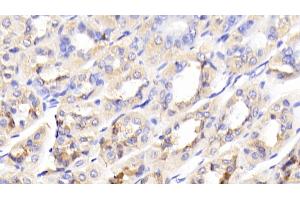 Detection of GCK in Mouse Stomach Tissue using Polyclonal Antibody to Glucokinase (GCK) (GCK antibody  (AA 3-226))