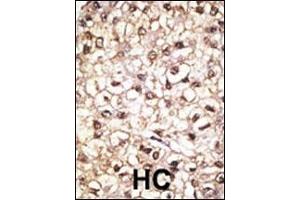 Immunohistochemistry (Paraffin-embedded Sections) (IHC (p)) image for anti-Parkinson Protein 2, E3 Ubiquitin Protein Ligase (Parkin) (PARK2) (AA 387-417), (C-Term) antibody (ABIN390366)
