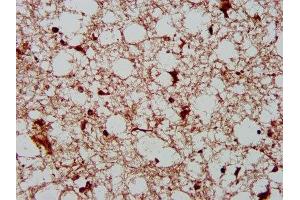IHC image of ABIN7165027 diluted at 1:400 and staining in paraffin-embedded human brain tissue performed on a Leica BondTM system. (AHNAK2 antibody  (AA 195-349))