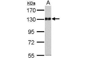 WB Image Amphiphysin antibody [N1N2], N-term detects AMPH protein by Western blot analysis.