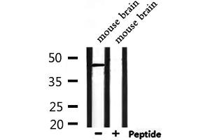 Western blot analysis of extracts from mouse brain, using NPY1R Antibody. (NPY1R antibody  (Internal Region))