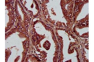 IHC image of ABIN7163316 diluted at 1:400 and staining in paraffin-embedded human prostate tissue performed on a Leica BondTM system. (PLA1A antibody  (AA 293-398))