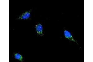 IF analysis of Filamin B/FLNB using anti-Filamin B/FLNB antibody (ABIN7601606). (FLNB antibody  (AA 397-701))