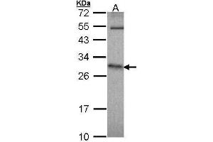 Western Blotting (WB) image for anti-Hypoxanthine phosphoribosyltransferase 1 (HPRT1) antibody (ABIN2854953)