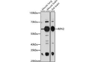 Western blot analysis of extracts of various cell lines, using RIPK2 antibody (ABIN3023312, ABIN3023313, ABIN3023314 and ABIN6219574) at 1:1000 dilution. (RIPK2 antibody  (AA 1-540))