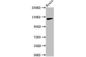 Western Blot Positive WB detected in: Mouse brain tissue All lanes: MYRF antibody at 3. (Chromosome 11open Reading Frame 9 (C11orf9) (AA 843-1004) antibody)