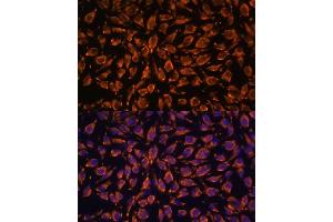 Immunofluorescence analysis of L929 cells using LRRC7 antibody (ABIN6128203, ABIN6143347, ABIN6143348 and ABIN6216986) at dilution of 1:100.