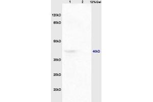 Lane 1: mouse embryo lysates Lane 2: mouse spleen lysates probed with Anti CCR9 Polyclonal Antibody, Unconjugated at 1:200 in 4 ˚C. (CCR9 antibody  (AA 65-160))