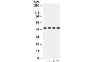 Western blot testing of 1) rat lung, 2) rat kidney, 3) human COLO320 and 4) MCF7 lysate with CTBP1 antibody.