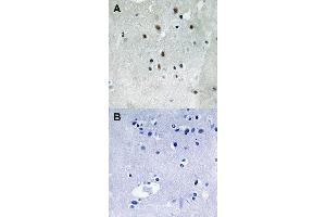 Immunohistochemical staining (Formalin-fixed paraffin-embedded sections) of human brain tissue with SRF (phospho S77) polyclonal antibody  under 1:50-1:100 dilution (A) or treated with synthesized peptide (B). (SRF antibody  (pSer77))