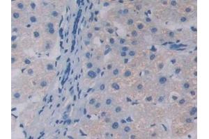 Detection of APOA5 in Human Liver Tissue using Polyclonal Antibody to Apolipoprotein A5 (APOA5) (APOA5 antibody  (AA 167-335))