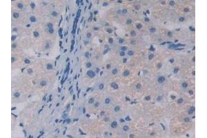 Detection of APOA5 in Human Liver Tissue using Polyclonal Antibody to Apolipoprotein A5 (APOA5)