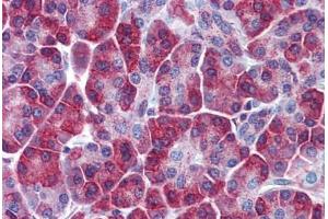 Human Pancreas: Formalin-Fixed, Paraffin-Embedded (FFPE) (SQSTM1 antibody  (AA 323-372))