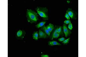 Immunofluorescence staining of A549 cells with ABIN7144485 at 1:166, counter-stained with DAPI. (APAF1 antibody  (AA 104-415))