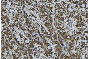 ABIN6268857 at 1/100 staining Mouse testis tissue by IHC-P. (CRHR1 antibody  (Internal Region))