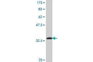 anti-SWI/SNF Related, Matrix Associated, Actin Dependent Regulator of Chromatin, Subfamily A, Member 2 (SMARCA2) (AA 659-735) antibody