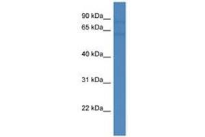 Image no. 1 for anti-SRY (Sex Determining Region Y)-Box 5 (SOX5) (AA 56-105) antibody (ABIN6746057) (SOX5 antibody  (AA 56-105))