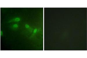 Immunofluorescence (IF) image for anti-Mdm2, p53 E3 Ubiquitin Protein Ligase Homolog (Mouse) (MDM2) (pSer186), (pSer188) antibody (ABIN7138400)