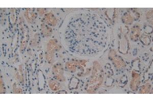 Immunohistochemistry (IHC) image for anti-Complement Component 1, Q Subcomponent Binding Protein (C1QBP) (AA 76-282) antibody (ABIN7432316)