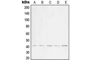 Western blot analysis of WNT1 expression in HEK293T (A), SP2/0 (B), H9C2 (C), WI38 (D), NIH3T3 (E) whole cell lysates. (WNT1 antibody  (C-Term))