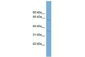 WB Suggested Anti-MFSD8 Antibody Titration: 0. (MFSD8 antibody  (Middle Region))