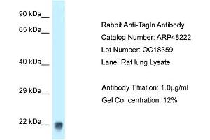 WB Suggested Anti-Tagln Antibody Titration:  1 ug/ml  Positive Control:  Rat Lung lysate (Transgelin antibody  (C-Term))