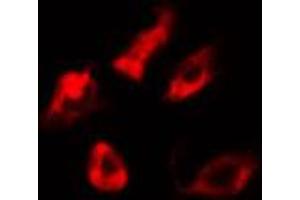 ABIN6274638 staining 293 cells by IF/ICC. (CYP21A2 antibody  (Internal Region))