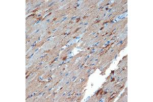 Immunohistochemistry of paraffin-embedded rat heart using Creatine kinase B type (CKB) Rabbit mAb (ABIN7266515) at dilution of 1:100 (40x lens). (CKB antibody)