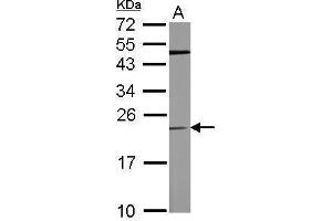 WB Image Sample (50 ug of whole cell lysate) A: mouse brain 12% SDS PAGE antibody diluted at 1:500 (TPT1 antibody)