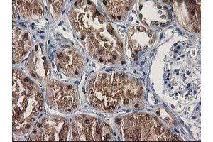Immunohistochemical staining of paraffin-embedded Human Kidney tissue using anti-SULT1C2 mouse monoclonal antibody. (SULT1C2 antibody)
